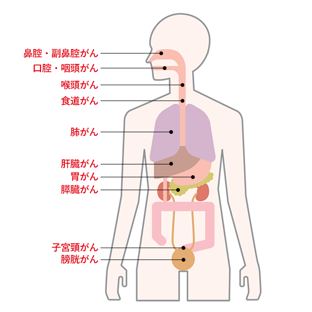 喫煙者がなりやすいがん